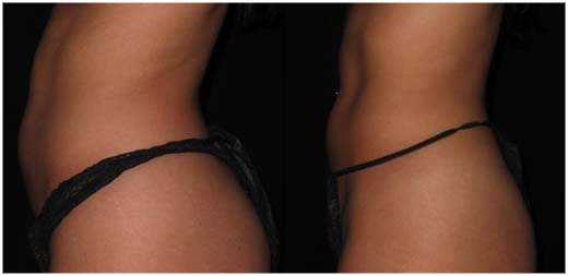 body before and after
