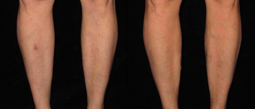 veins gallery
