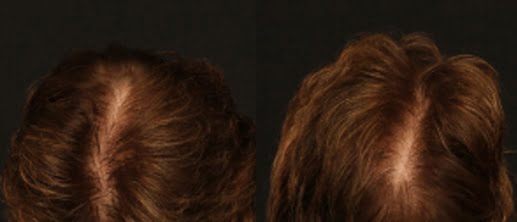 hair gallery