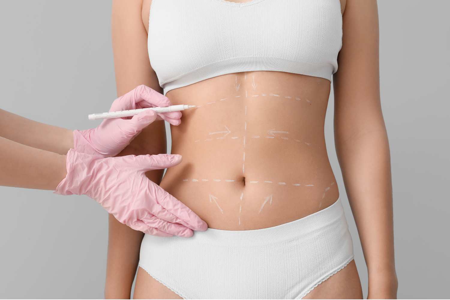 Good Candidate For Liposuction