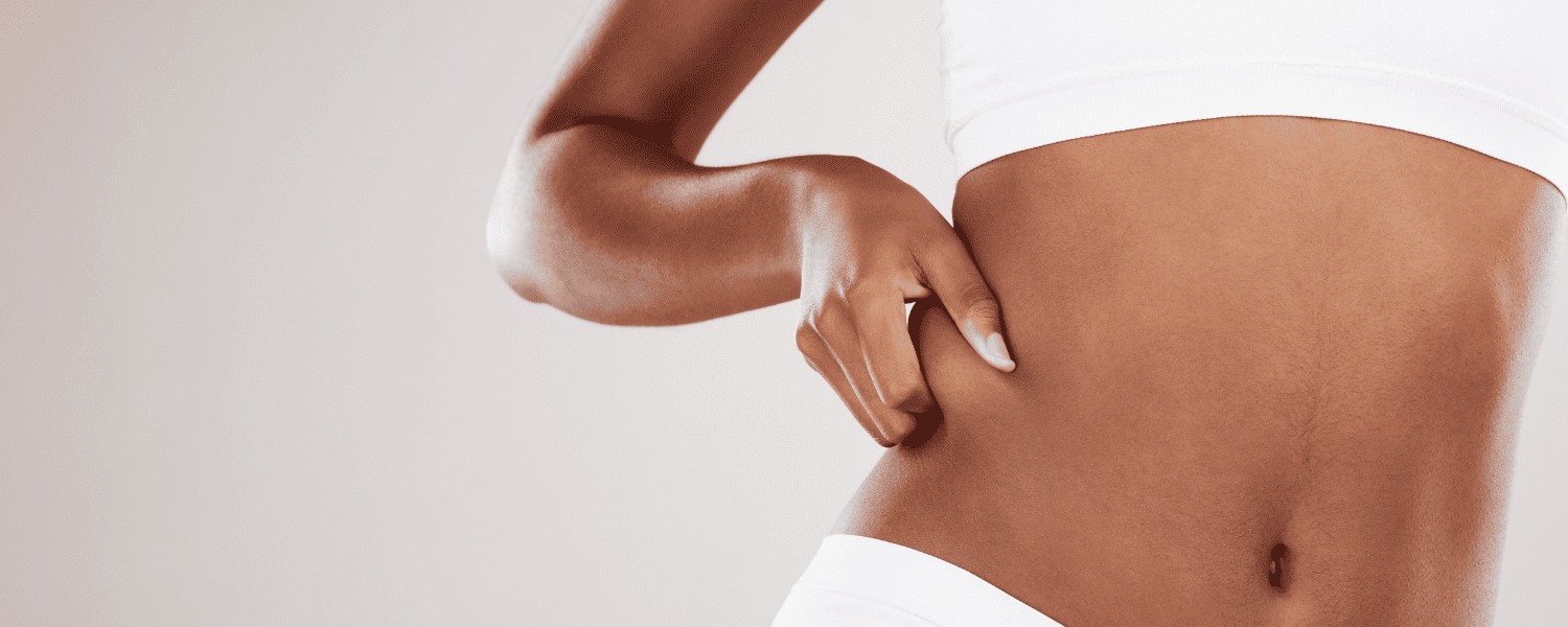 Liposuction